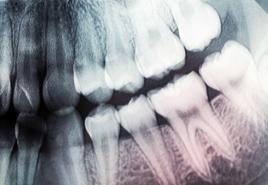 Regeneracijos būdas arba naujų dantų auginimas vietoj pašalintų pagal Norbekovą, Shichko ir mokslininkų raidą Dantų kamieninės ląstelės