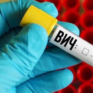 Gdje i kako se anonimno testirati na HIV infekciju