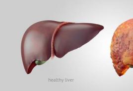Koji su glavni simptomi ciroze jetre?