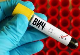 익명으로 HIV 감염 검사를 받는 장소와 방법