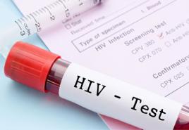 HIV un hepatīta analīze, kāpēc un kā lietot